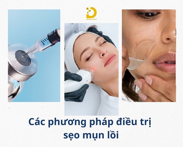 tri seo do mun trung ca 5