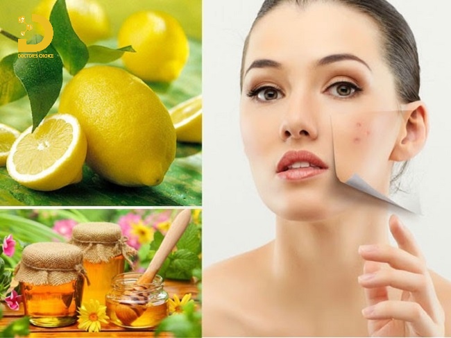 Các nguyên liệu tự nhiên điều trị thâm da hiệu quả