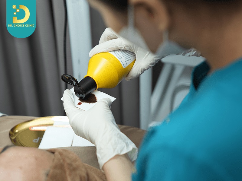 cong nghe tri nam da hieu qua