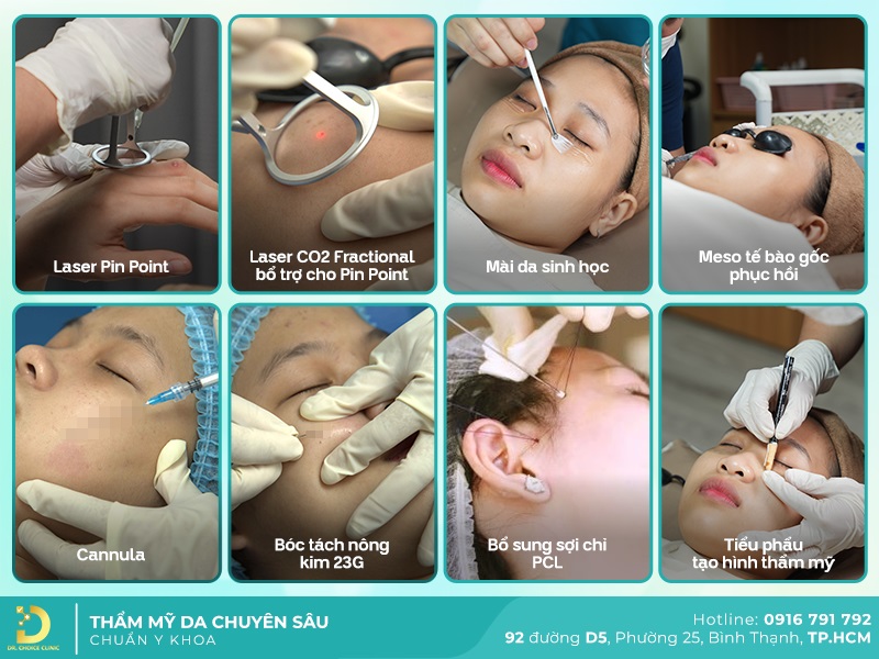 Điều Trị Sẹo Mất Sắc Tố (Sẹo Trắng) Nhanh Chóng, An Toàn HCM 27 công nghệ trị sẹo trắng