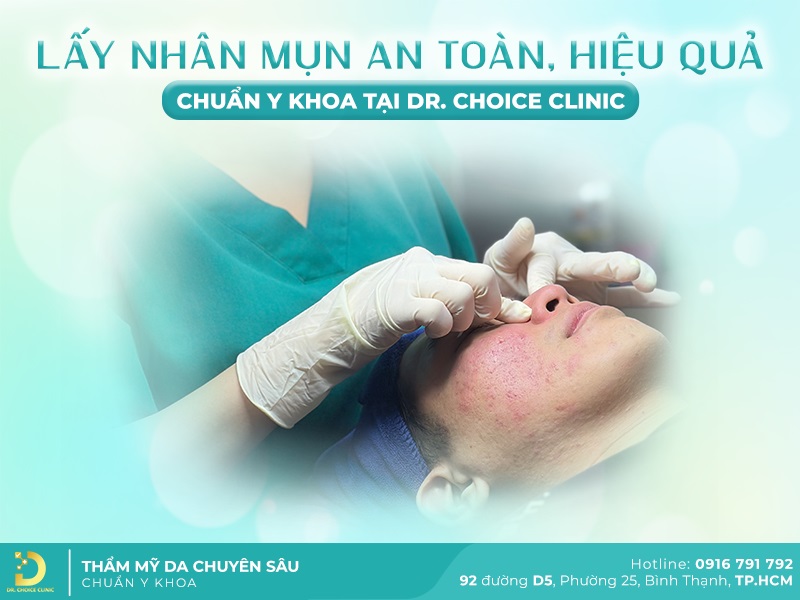 Dịch vụ lấy nhân mụn an toàn chuẩn y khoa