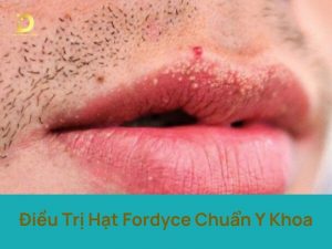 dieu tri hat fordyce