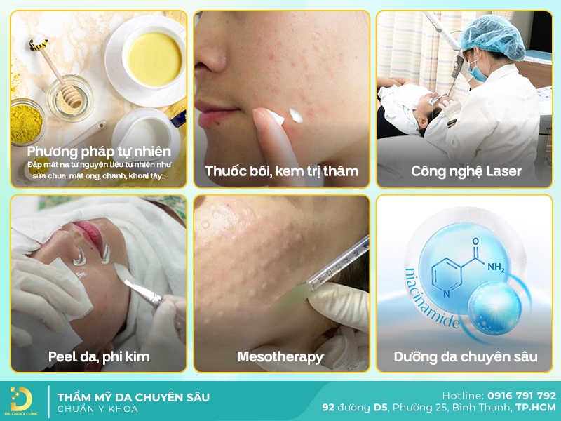 Dịch Vụ Điều Trị Thâm Mặt Chuẩn Y Khoa, An Toàn Tại TP.HCM 11 Phương pháp điều trị thâm mặt