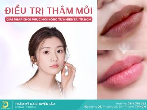 điều trị thâm môi