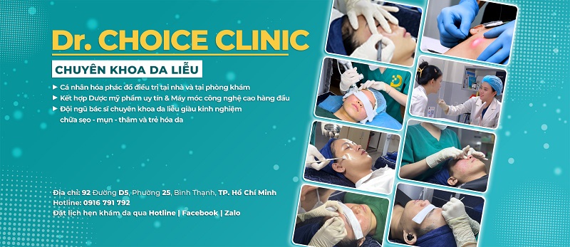Điều Trị U Treo Mềm Nhanh Chóng, An Toàn HCM 9 Dr. Choice Clinic địa chỉ điều trị da chuyên sâu
