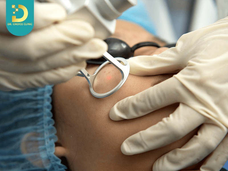 lieu trinh tri nam da