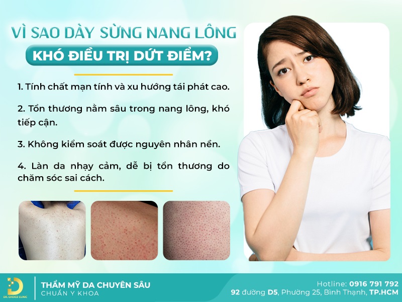 Lý do dày sừng nang lông khó điều trị dứt điểm