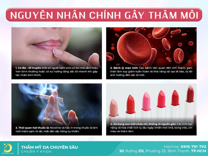 Dịch Vụ Điều Trị Thâm Môi Hiệu Quả, An Toàn Tại TP.HCM 10 nguyên nhân gây thâm môi