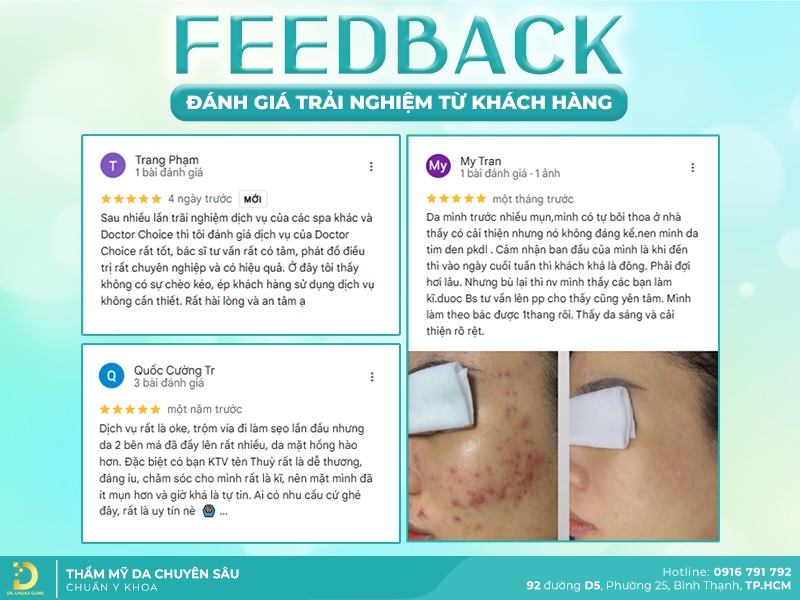 phan hoi khach hang 2