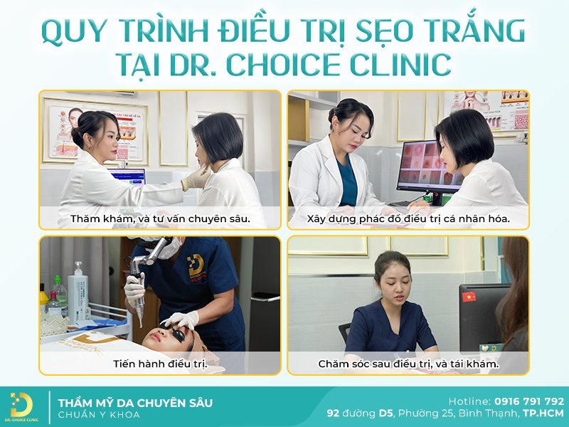 Điều Trị Sẹo Mất Sắc Tố (Sẹo Trắng) Nhanh Chóng, An Toàn HCM 17 quy trình điều trị sẹo trắng