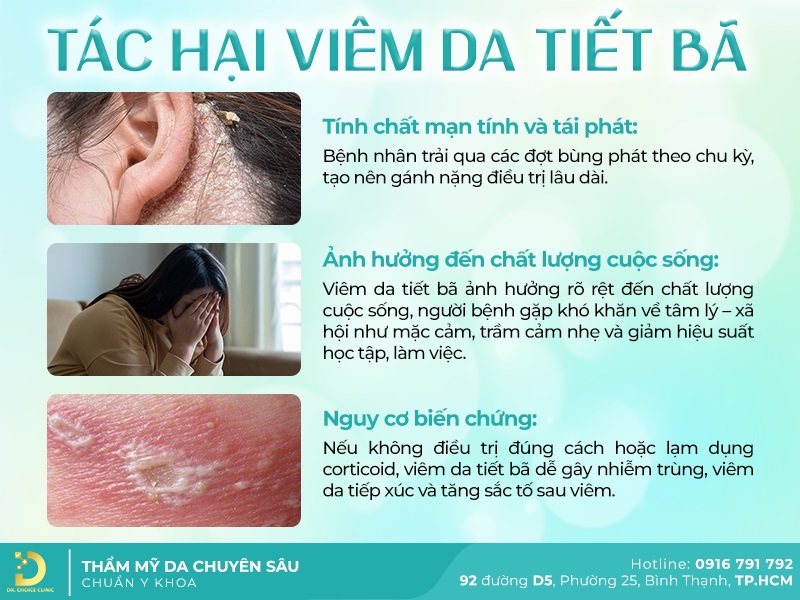 Tác hại của viêm da tiết bã