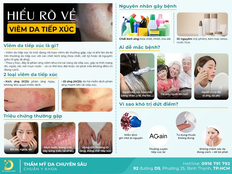 Những vấn đề cần biết về viêm da tiếp xúc