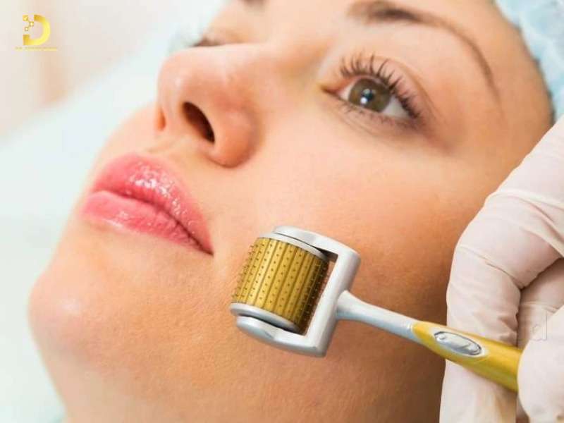 Nguyên tắc chăm sóc & điều trị sẹo đáy nhọn