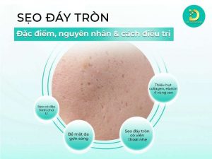 Sẹo đáy tròn