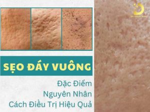 Sẹo đáy vuông