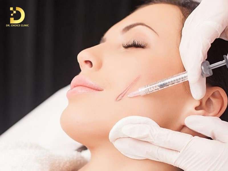 Tiêm Sẹo Lồi: Đặc Điểm, Công Dụng, Các Loại Và Lưu Ý Điều Trị 9 Tiêm sẹo lồi là gì