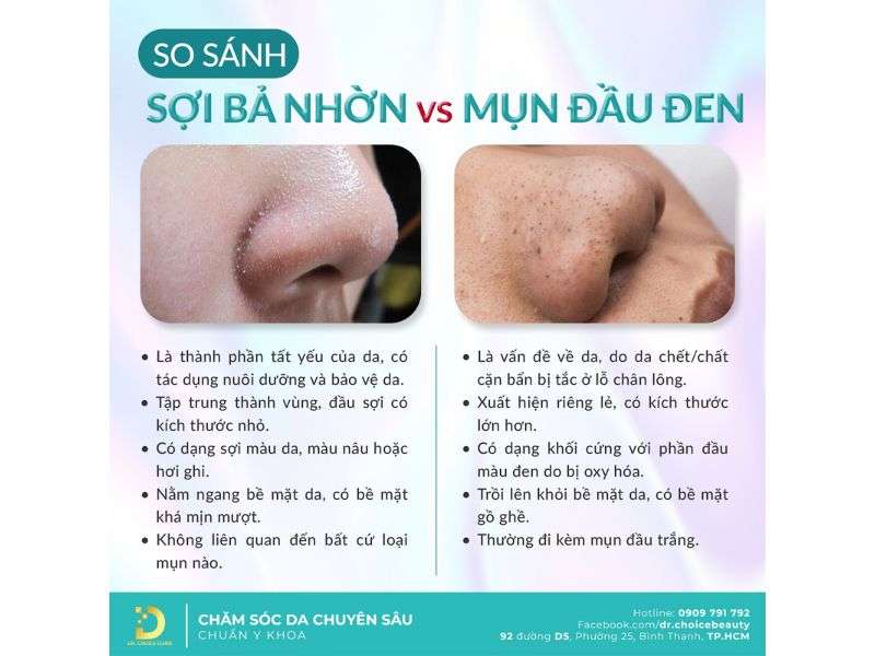 Mụn Đầu Đen & Sợi Bã Nhờn: Phân Biệt Để Điều Trị Hiệu Quả 17 Cách phân biệt mụn đầu đen và sợi bã nhờn