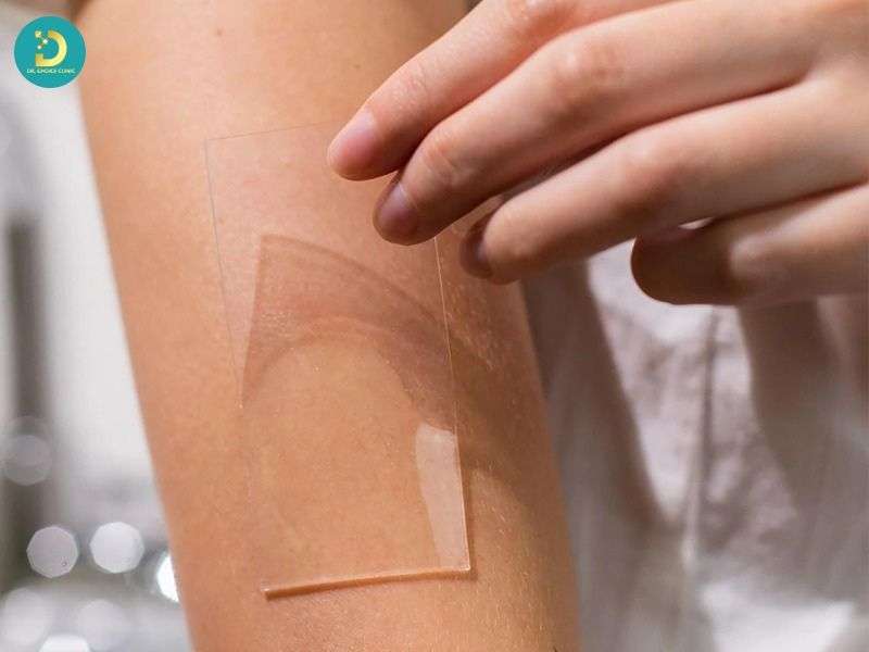 Chăm sóc da và giảm sức căng vùng sẹo