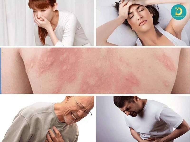 Dấu hiệu nguy hiểm cần đi khám hoặc cấp cứu ngay