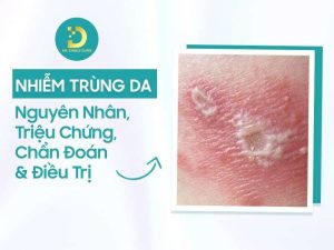 Nhiễm trùng da