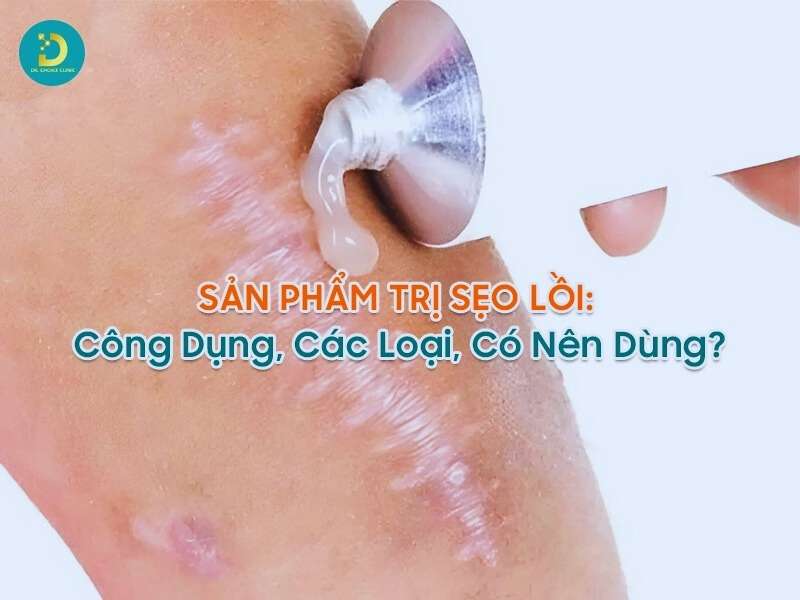 Sản Phẩm Trị Sẹo Lồi: Công Dụng, Hiệu Quả, Các Loại, Có Nên Dùng? 11 Sản phẩm trị sẹo lồi