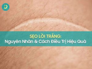 Sẹo lồi trắng