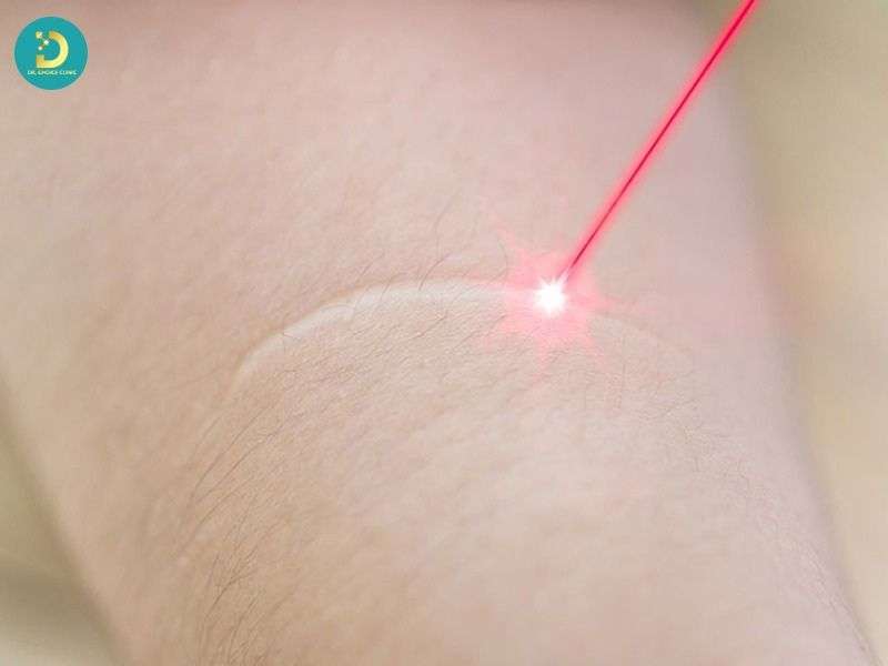 Tác dụng phụ từ điều trị sai cách