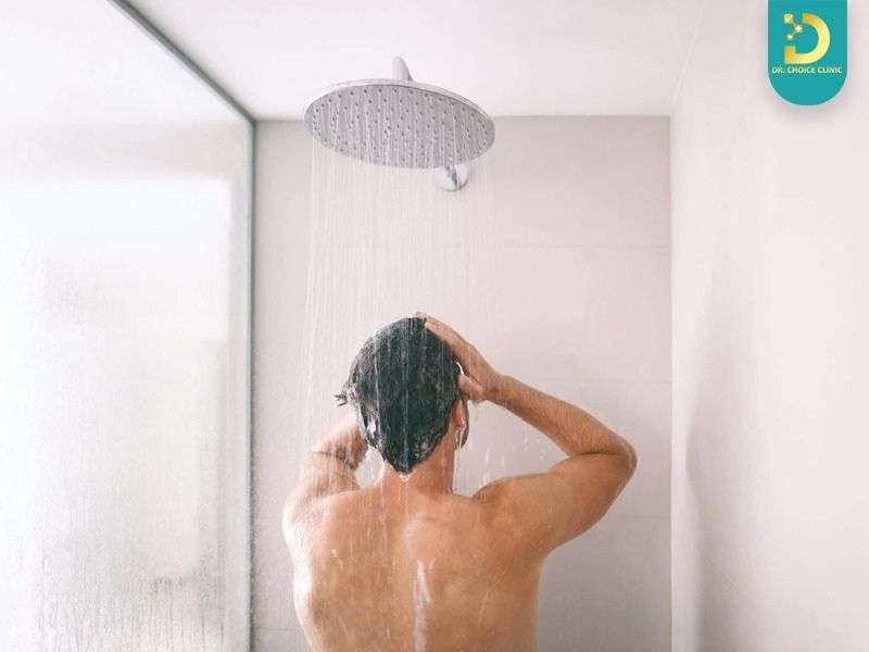 Vảy nến nên tắm nước nóng hay lạnh?