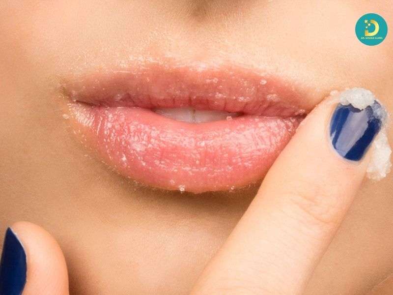 Môi Thâm: Nguyên Nhân & Cách Điều Trị Hiệu Quả 13 Các cách trị môi thâm tại nhà: chỉ phù hợp với thâm nhẹ