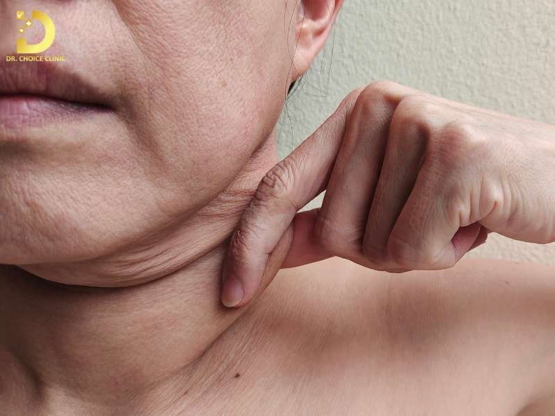 Lão Hóa Da Cổ: Nguyên Nhân, Dấu Hiệu & Cách Khắc Phục 11 Các dấu hiệu lão hóa da cổ theo cấp độ