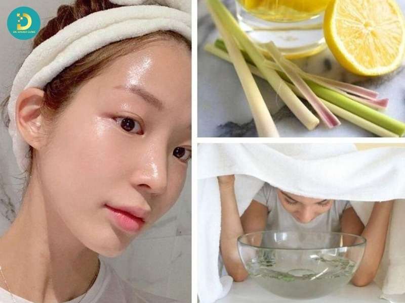 Các loại nguyên liệu xông hơi trị mụn phổ biến và cách lựa chọn