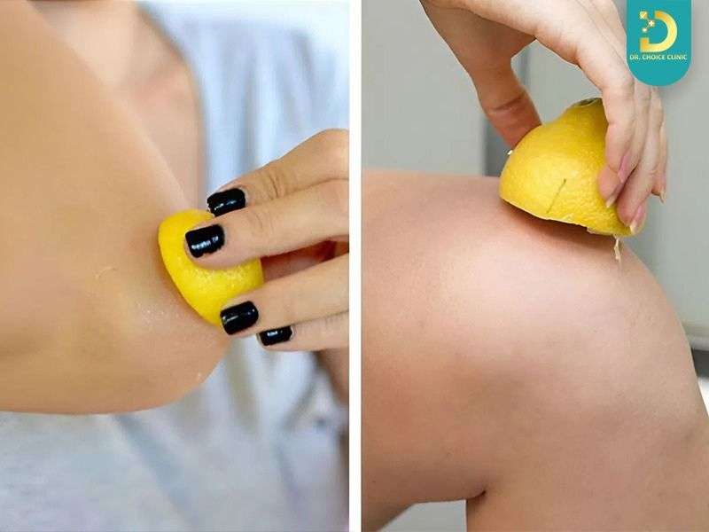 Chà xát, kỳ cọ quá mạnh khiến da thâm nặng hơn