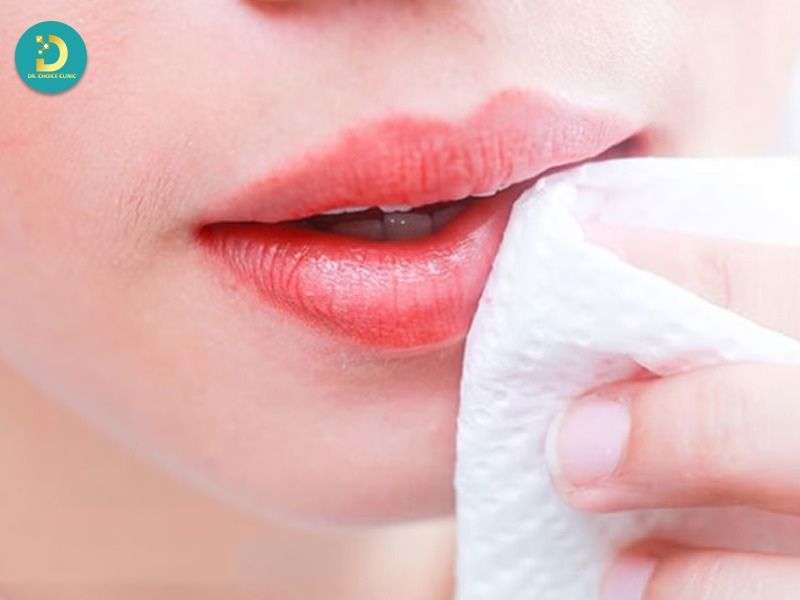 Môi Thâm: Nguyên Nhân & Cách Điều Trị Hiệu Quả 15 Chăm sóc môi đúng cách sau điều trị