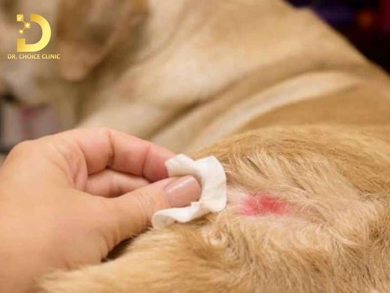 Chăm sóc và ngăn ngừa tái phát nấm thân mình như thế nào cho hiệu quả?