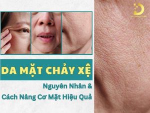 Da mặt chảy xệ