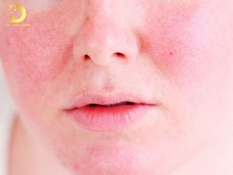 Dấu hiệu nào cho thấy da đang bị quá tải hoặc kích ứng với sản phẩm?