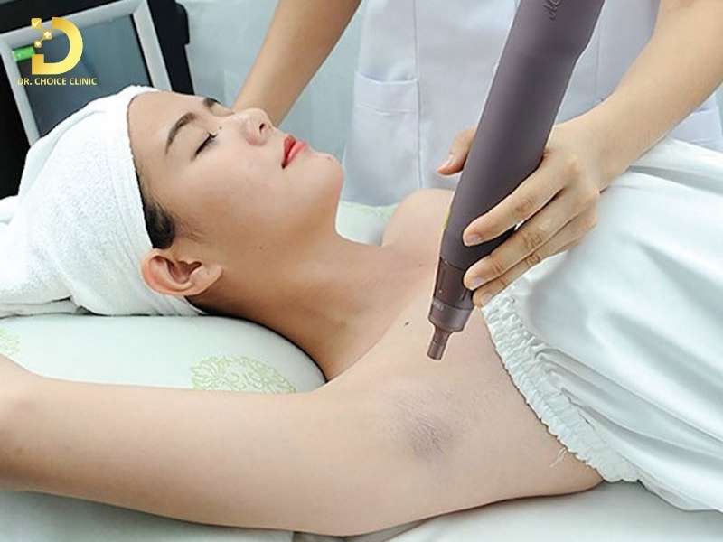 Đâu là cách trị thâm nách hiệu quả?