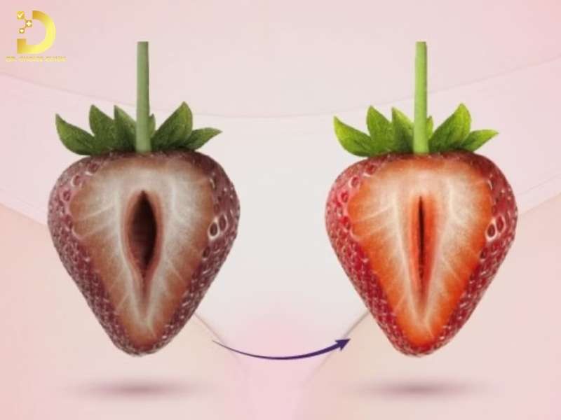 Điều trị thâm vùng kín như thế nào hiệu quả?