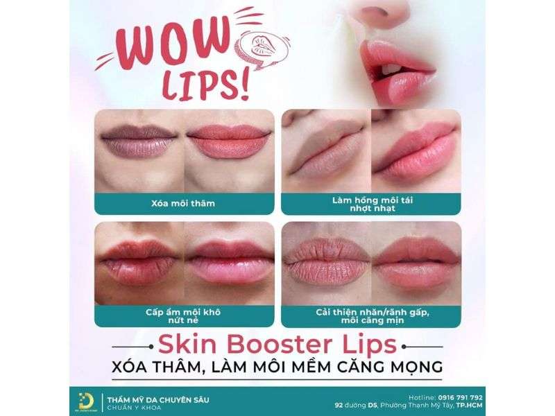 Môi Thâm: Nguyên Nhân & Cách Điều Trị Hiệu Quả 17 Dr. Choice Clinic điều trị thâm môi uy tín, chất lượng