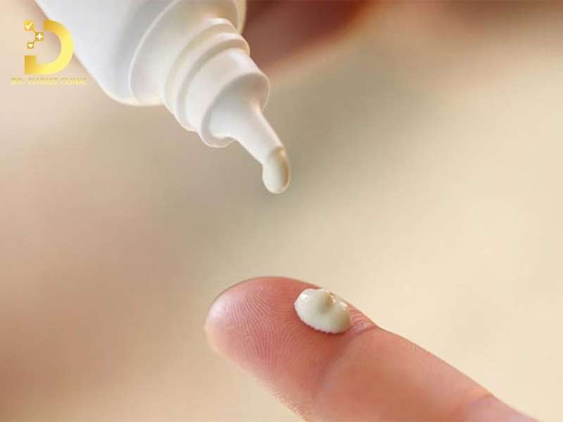 Khi nào dùng thuốc bôi trị nấm bẹn?