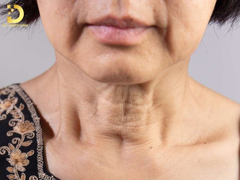 Lão Hóa Da Cổ: Nguyên Nhân, Dấu Hiệu & Cách Khắc Phục 9 Lão hóa da cổ là gì và cơ chế hình thành ra sao?