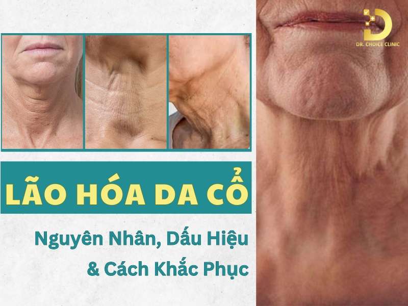 Lão Hóa Da Cổ: Nguyên Nhân, Dấu Hiệu & Cách Khắc Phục 8 Lão hóa da cổ