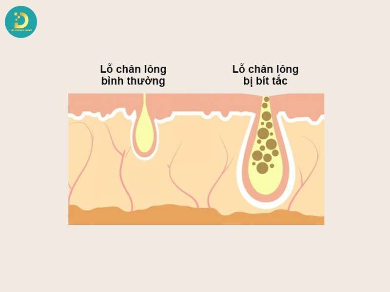 Nguyên nhân bên ngoài