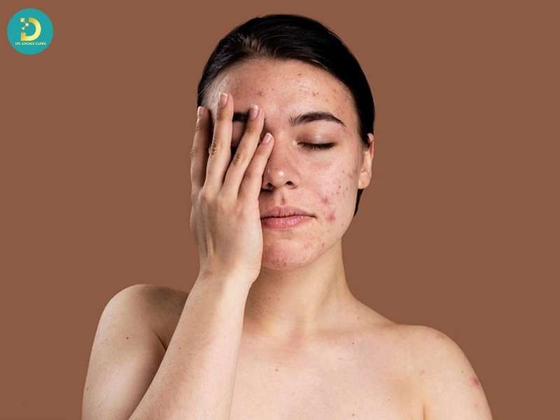 Nguyên nhân bên trong cơ thể