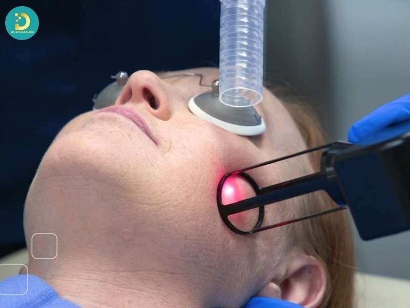 Nhóm trị mụn đa phương thức (phác đồ kết hợp)