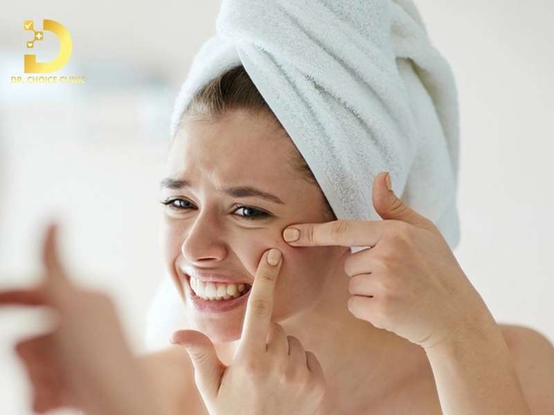 Những sai lầm nào phổ biến khiến tình trạng mụn không viêm trở nên trầm trọng hơn?