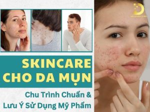 Skincare cho da mụn