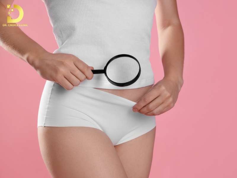 Thâm vùng kín là gì và vì sao tình trạng này phổ biến?