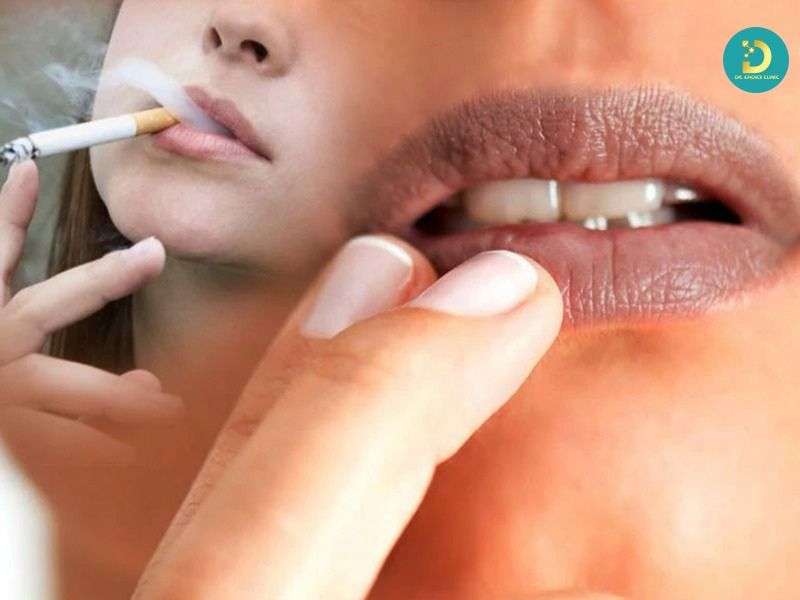 Môi Thâm: Nguyên Nhân & Cách Điều Trị Hiệu Quả 12 Thói quen sinh hoạt và tác nhân ngoại cảnh làm môi ngày càng thâm