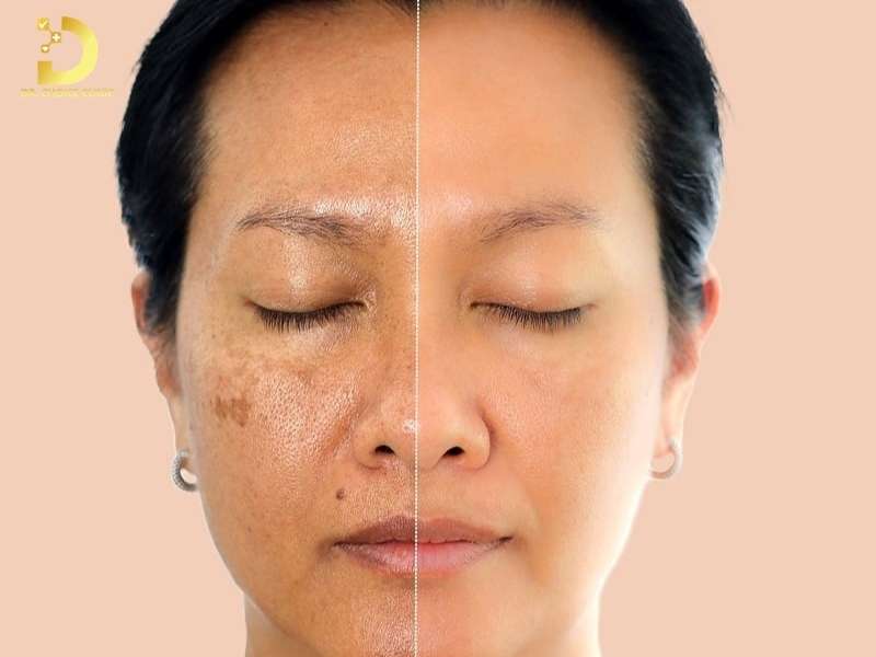 Vì sao da cần treatment từ sau tuổi 25? cơ chế và nhóm hoạt chất chính